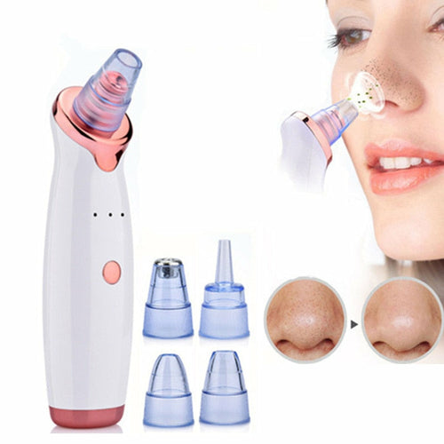 Aspirateur électrique pour éliminer les points noirs du visage / Facial Blackhead Remover Electric Vacuum Machine